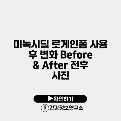 미녹시딜 로게인폼 사용 후 변화 Before & After 전후 사진